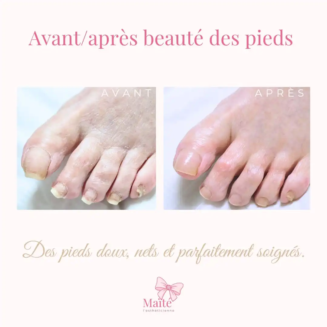 Beauté des pieds