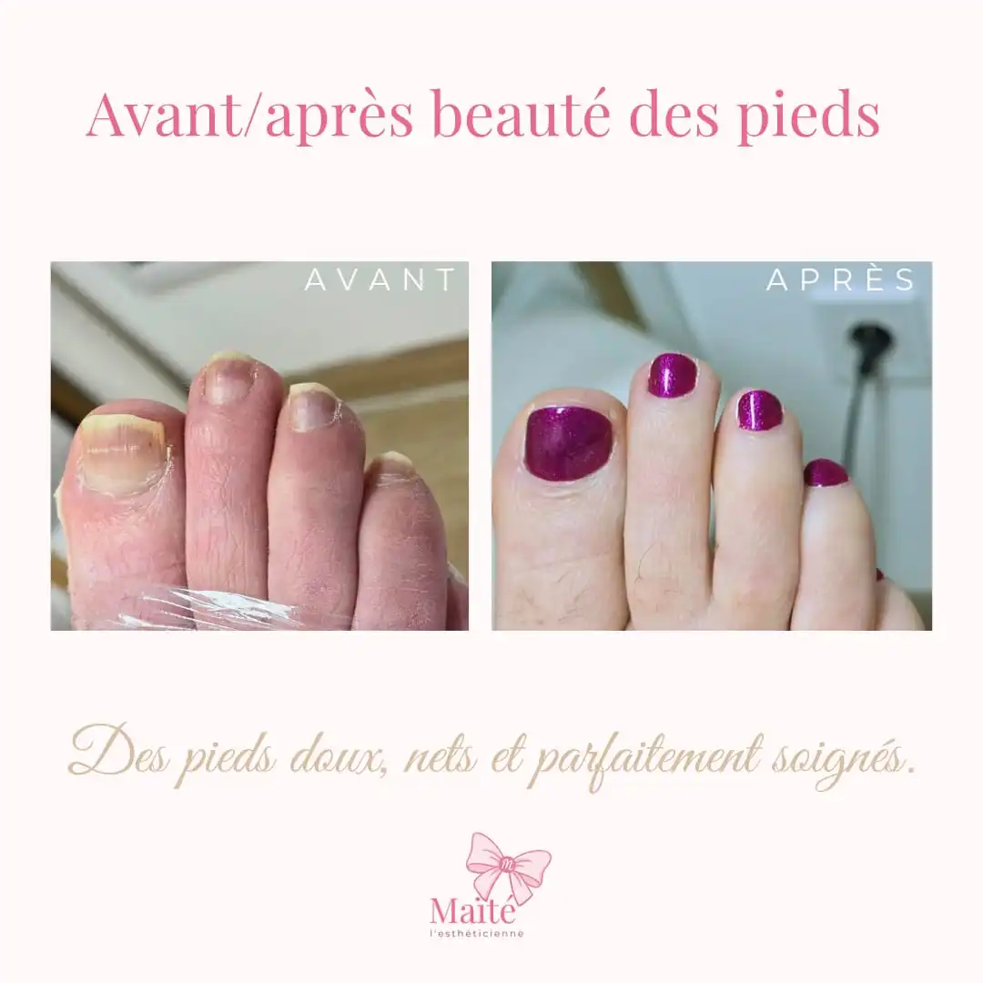 Soin pieds